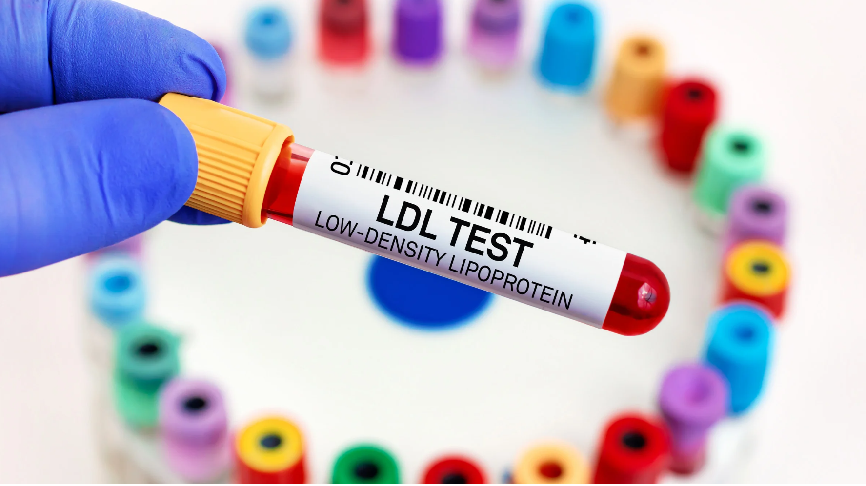 Understanding TRT bloodwork