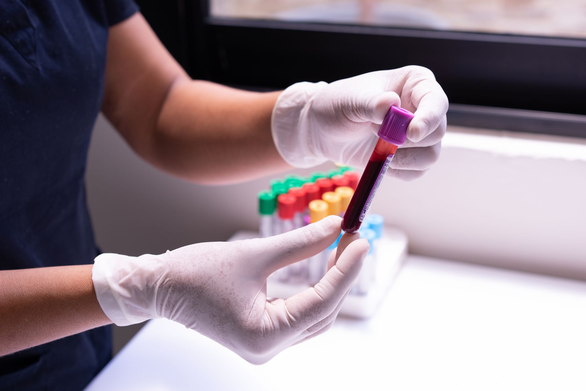 Oestradiol blood testing when considering letrozole during TRT