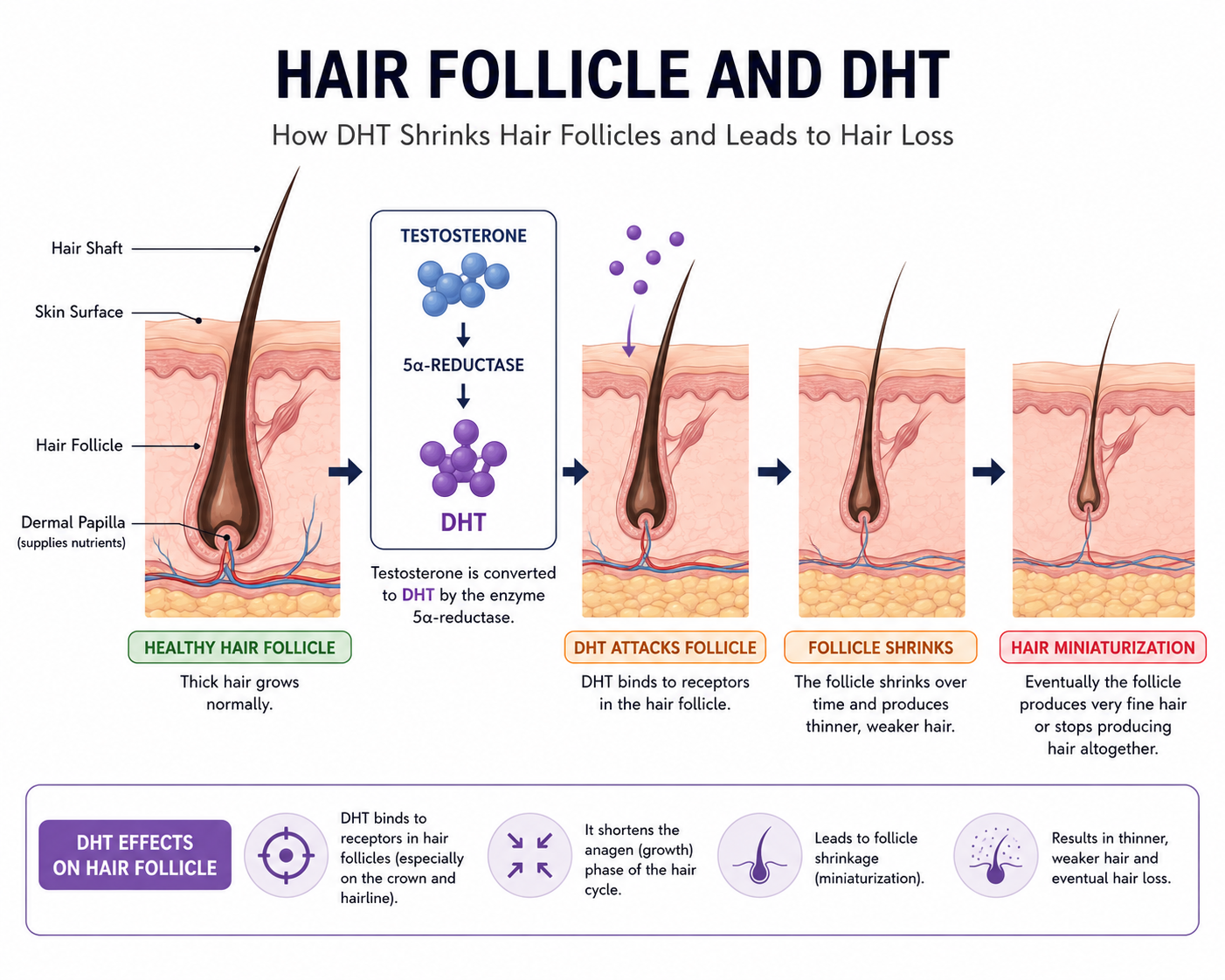 Diagram of hair follicle and DHT or medical concept