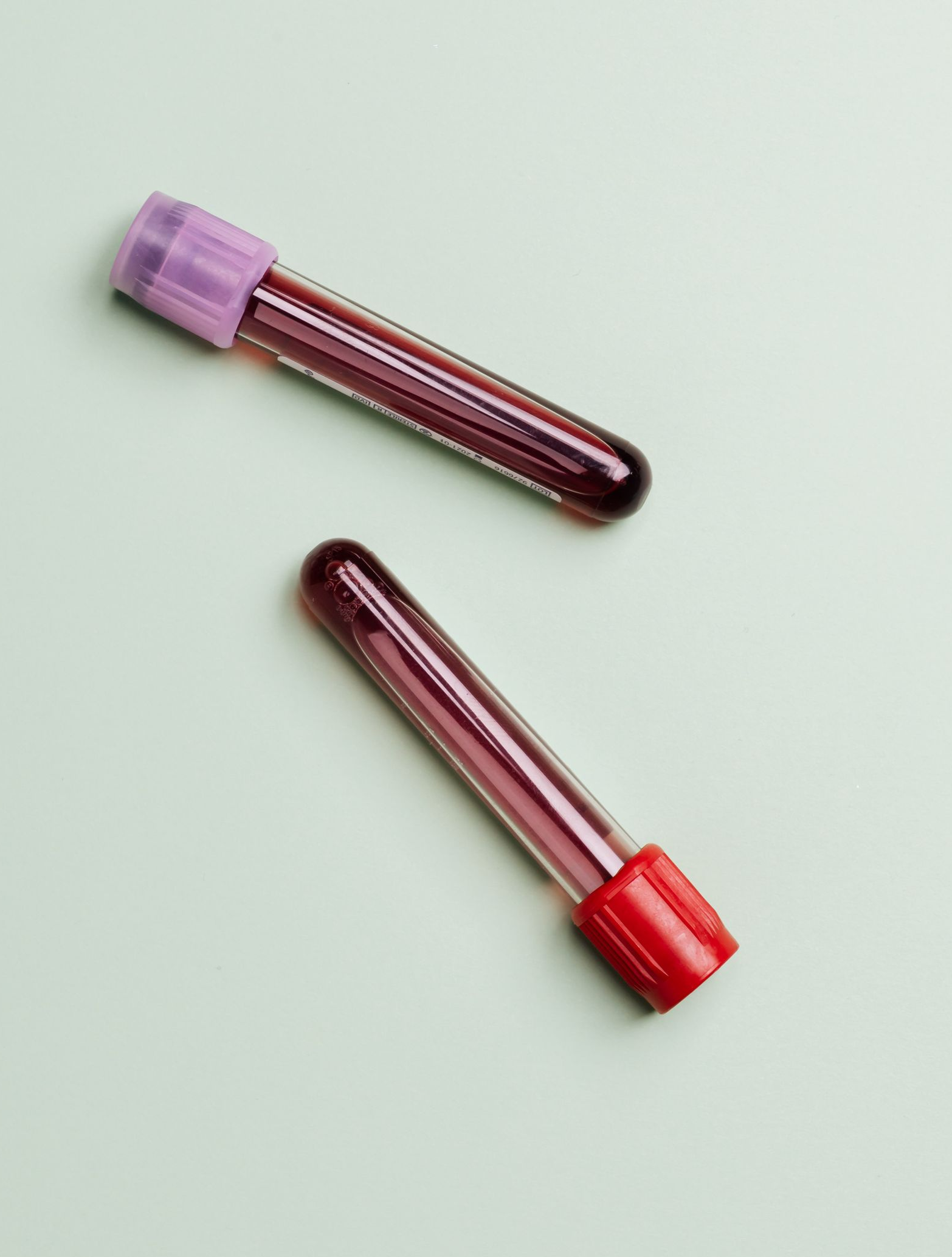 Oestradiol blood testing when considering anastrozole during TRT